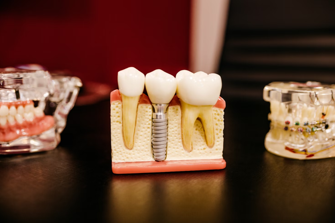 Absolute Dental Confirms 1.2 Million Victims in Earlier Data Breach