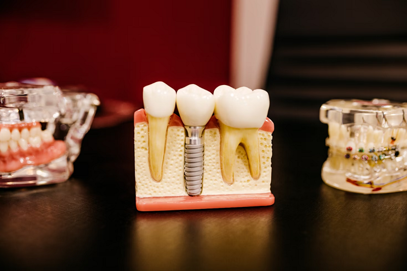 Absolute Dental Confirms 1.2 Million Victims in Earlier Data Breach